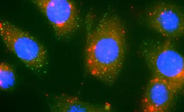 Новая светящаяся молекула поможет в борьбе с онкозаболеваниями 